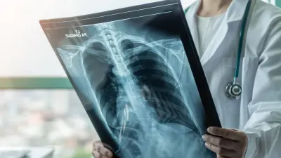 Tuberculosis leads male deaths, diabetes tops among women — TimesLIVE