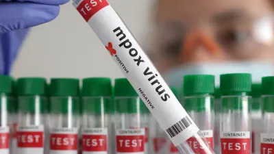 Mpox case confirmed in northeastern DRC city at the centre of the Ebola outbreak — SowetanLIVE