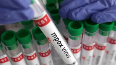 Gauteng activates Mpox response teams after three confirmed cases — SowetanLIVE