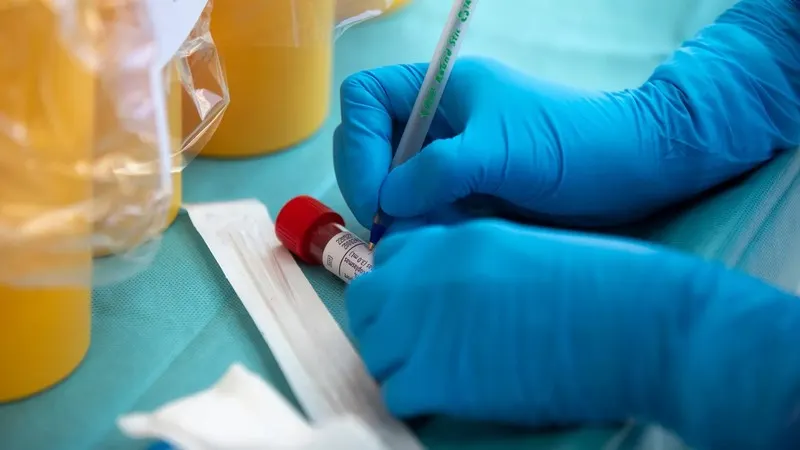 Researchers feel the strain as US funding dries up — photograph supplied by Cape Times / IOL Cape