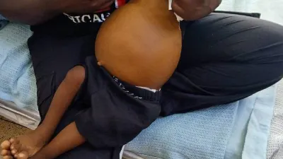 11 Months of pain: Baby Ethan's deadly fight for a new liver that never came — Standard Kenya